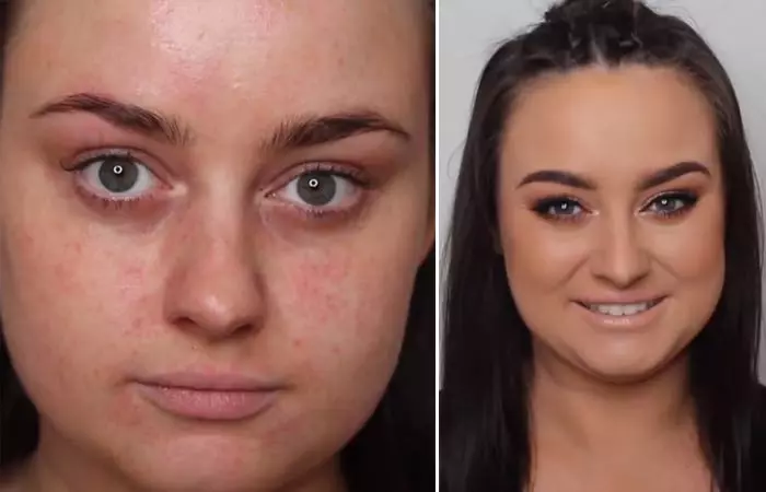 How To Hide Pimples With Makeup - How To Hide Eczema With Makeup