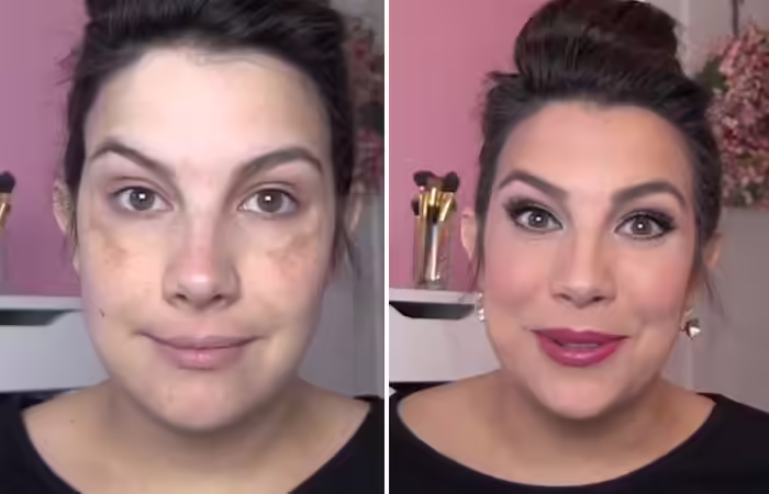 How To Hide Melasma With Makeup How To Hide Pimples With Makeup - How To Hide Melasma With Makeup