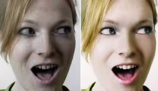 Fair Skin From Sun Damage Fair Skin From Sun Damage