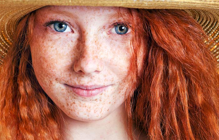 3. Sun Damage Or Sunspots