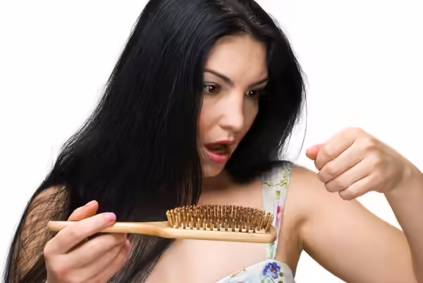 alopecia or hair loss alopecia or hair loss