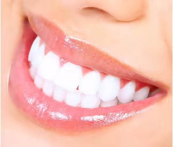 Bridal Accessory Smile Bridal Accessory Smile