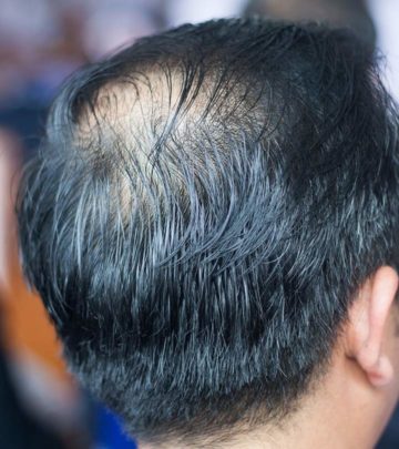 Top 10 Hair Transplantation Centers In Kolkata