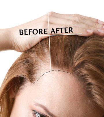 Top 10 Hair Transplant Centers In Lucknow