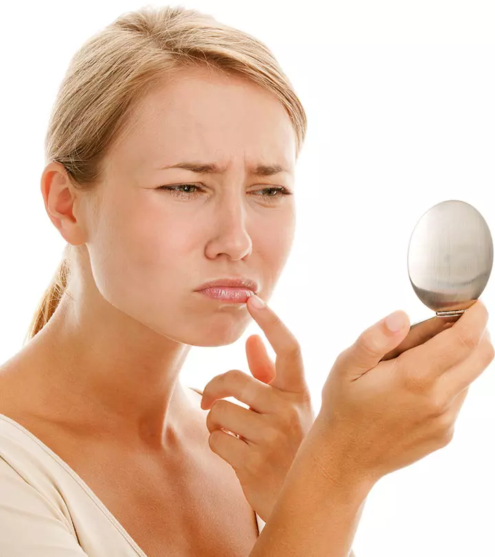 Cold Sore Vs. Pimple: Causes, Symptoms, And Treatment