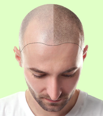 Top-10-Hair-Transplantation-Centers-In-Punjab