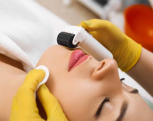Dermaroller Treatment At The Clinic For Acne Scars