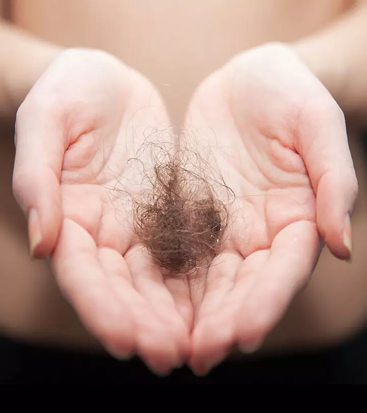 Top 5 Permanent Cures To Treat Hair Loss_image