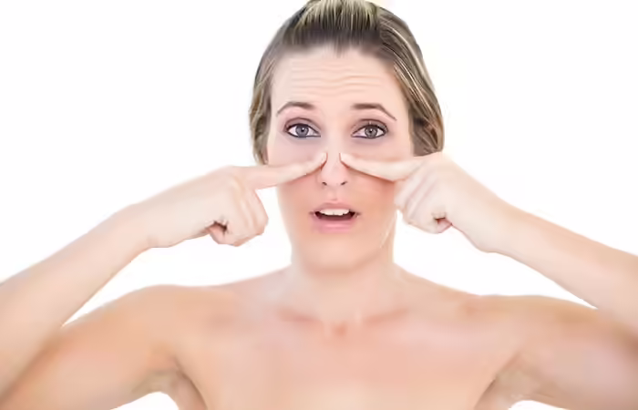 a. Blackheads