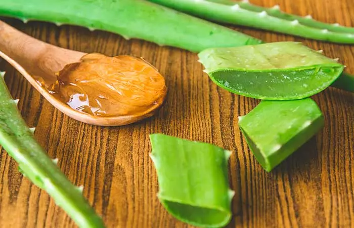  How To Get Rid Of Sunburn Blisters - Aloe Vera