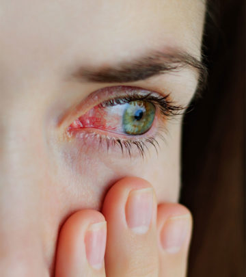 Pink Eye (Conjunctivitis) – Types, Causes, Symptoms, And Natural Treatment Options