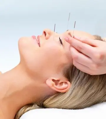 The Effect Of Acupuncture On Your Health And Insomnia_image