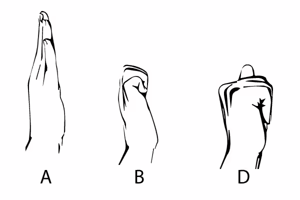 Hand Exercises - Hand Tendon Glide hand tendon glide