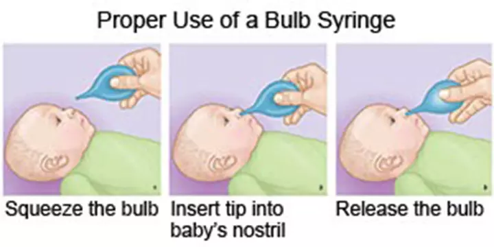 The proper way to use a bulb syringe for a choking baby