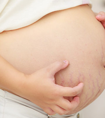 10 Effective Measures To Prevent Itching During Pregnancy