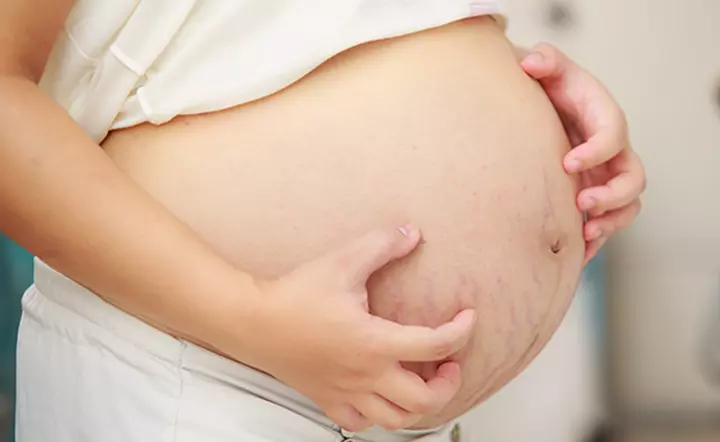 10 Effective Measures To Prevent Itching During Pregnancy_image