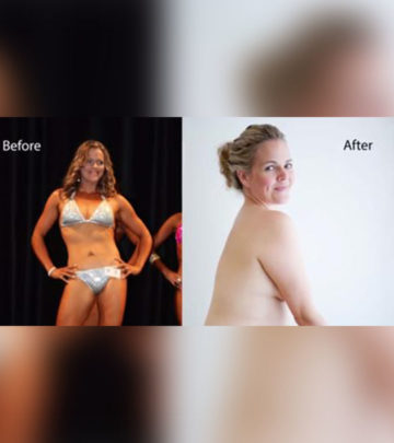 The Story Behind One Of The Best Before-And-After Photos