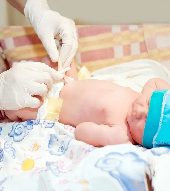 4 Simple Ways To Take Care Of Your New Born Baby’s Belly Button