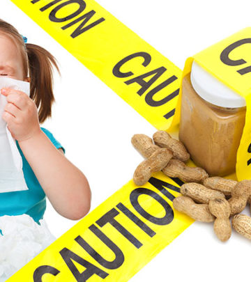 3 Simple Ways To Treat Peanut Allergy In Children