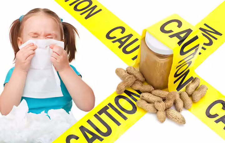 Peanut Allergy Treat Peanut Allergy