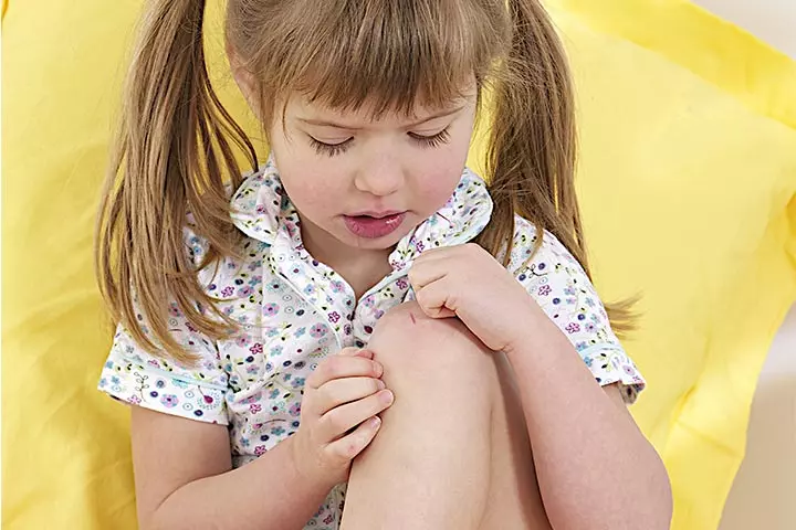 Juvenile Idiopathic Arthritis In Children – 7 Symptoms & 4 Remedies_image