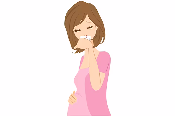 Nosebleeds During Pregnancy nose bleeding during pregnancy