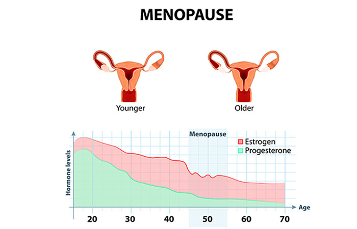 Hormone Therapy