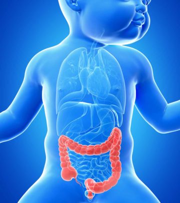 Necrotizing Enterocolitis: Causes, Symptoms And Treatment_image