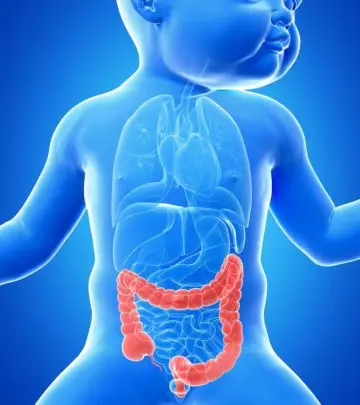 Necrotizing Enterocolitis: Causes, Symptoms And Treatment_image