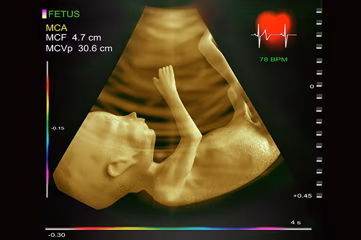 fetal echo