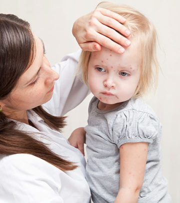 Measles In Toddlers – 3 Causes, 9 Symptoms & 8 Treatments