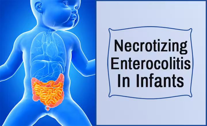 Necrotizing Enterocolitis necrotizing enterocolitis causes
