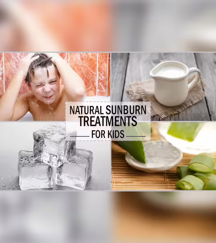 4 Effective Natural Remedies To Soothe Sunburns In Kids