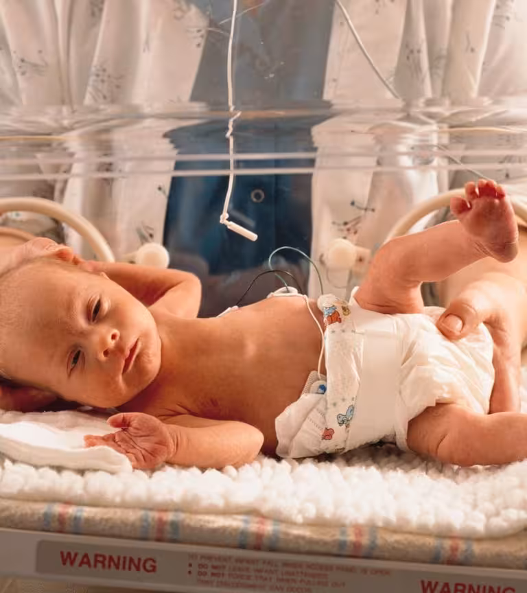 6 Causes And 5 Treatments Of Epilepsy In Babies