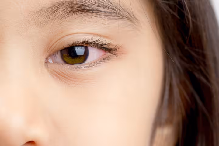 Corneal Abrasion Corneal Abrasion In Children