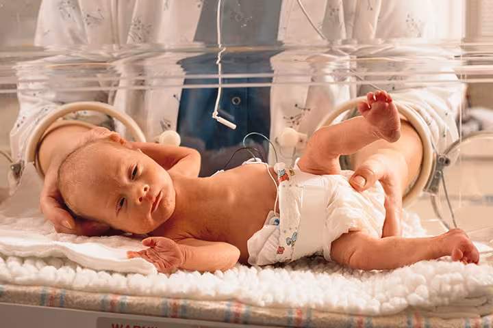 Epilepsy In Babies