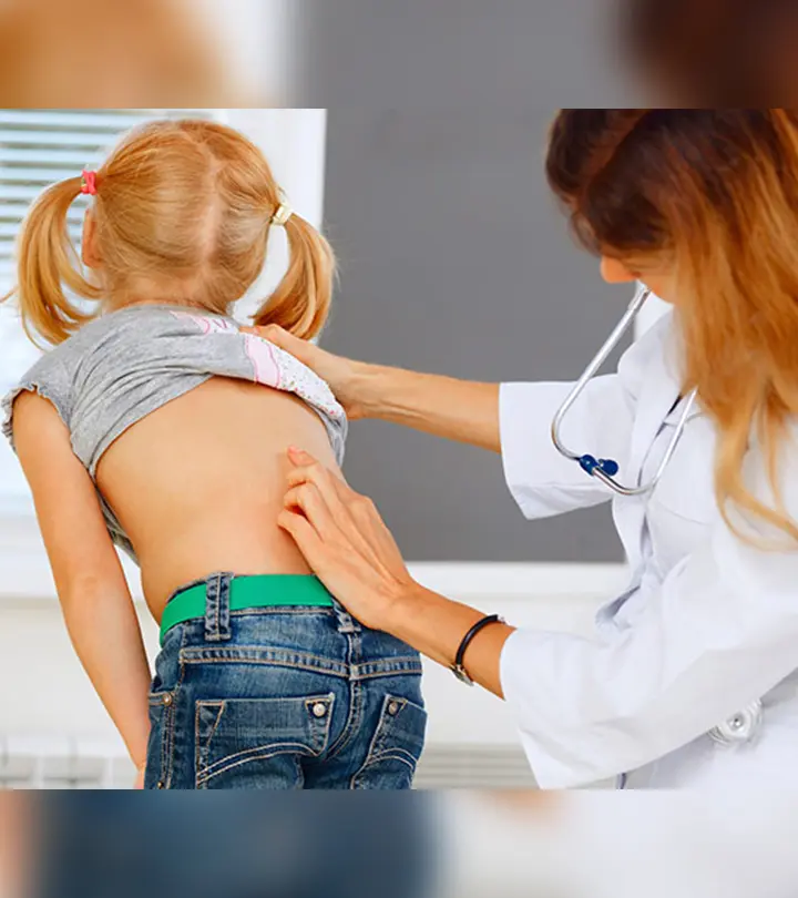 Scoliosis In Children What Causes It And How To Treat