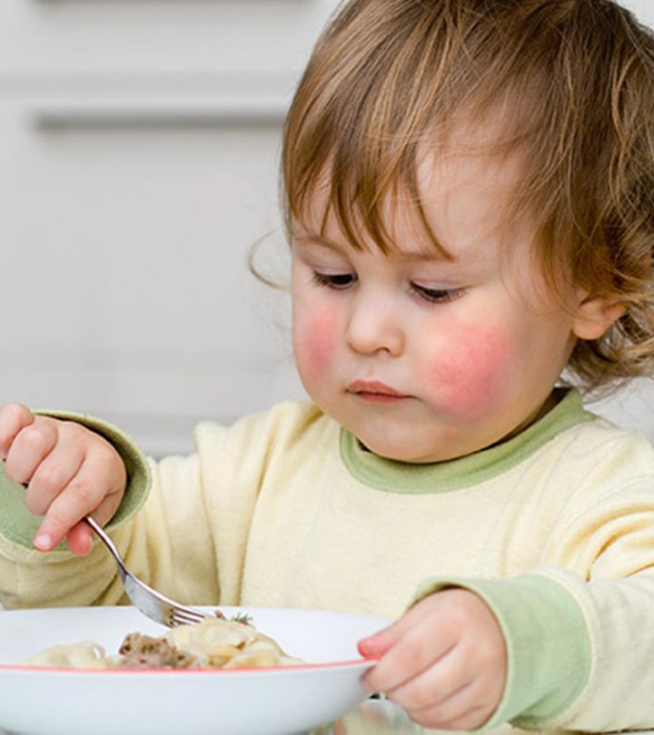 17 Serious Symptoms Of Food Allergy In Toddlers