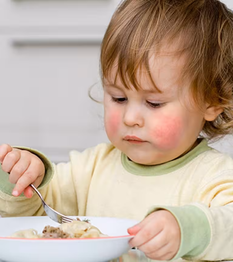 17 Serious Symptoms Of Food Allergy In Toddlers