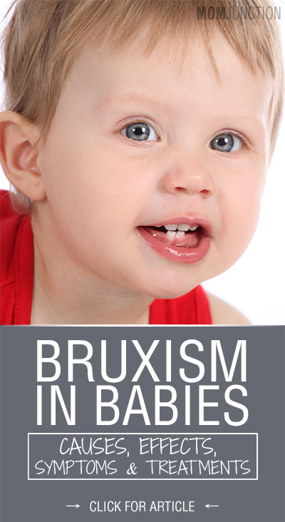 Bruxism-In-Babies-–-Causes-Effects-Symptoms-Treatments