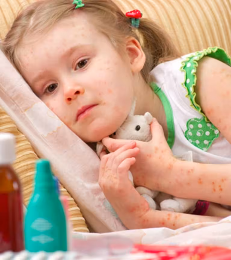 Folliculitis In Children – Causes, Symptoms And Treatment
