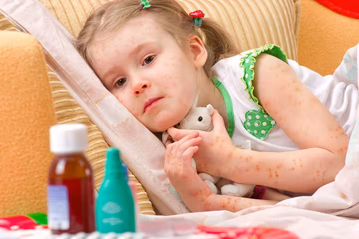 Folliculitis In Children - Images Images Of Folliculitis In Children
