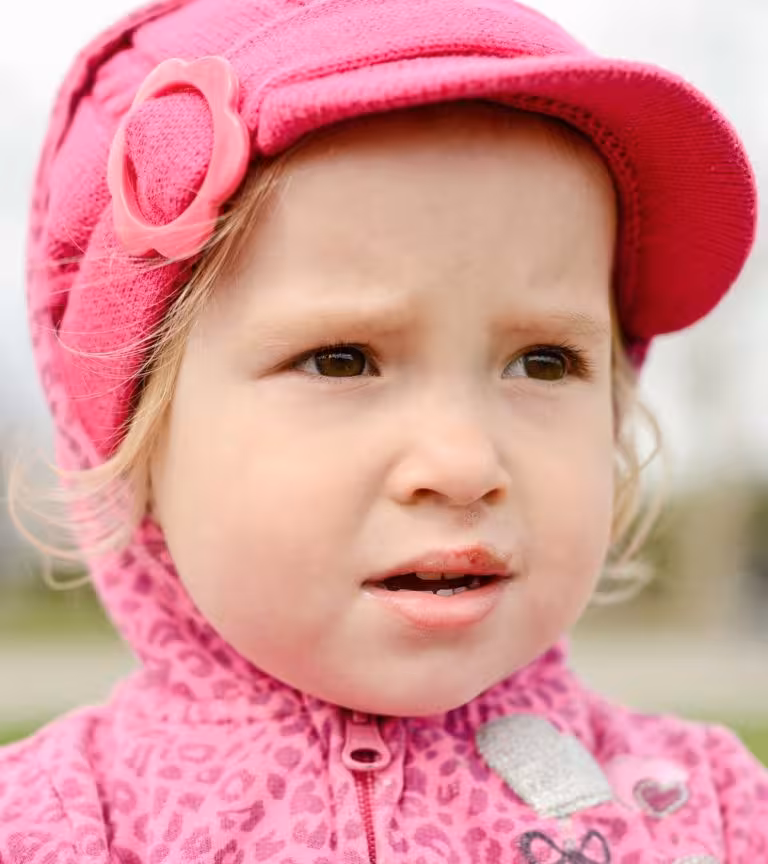Nosebleed In Toddlers Why Is It Caused And How To Control It