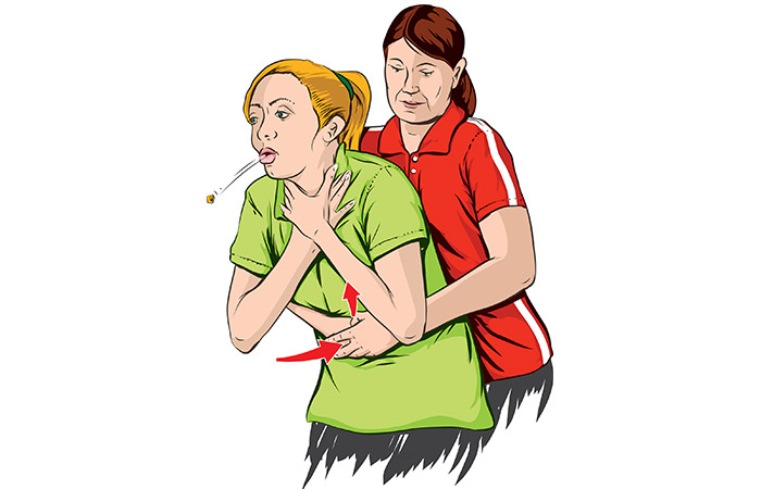 How to help a choking person How to help a choking person
