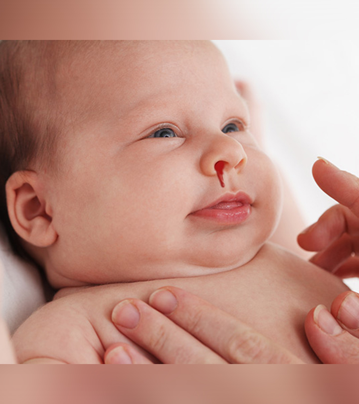 11 Simple Steps To Soothe Nose Bleeding In Babies_image