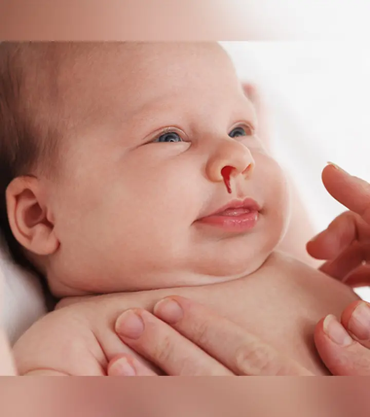 11 Simple Steps To Soothe Nose Bleeding In Babies