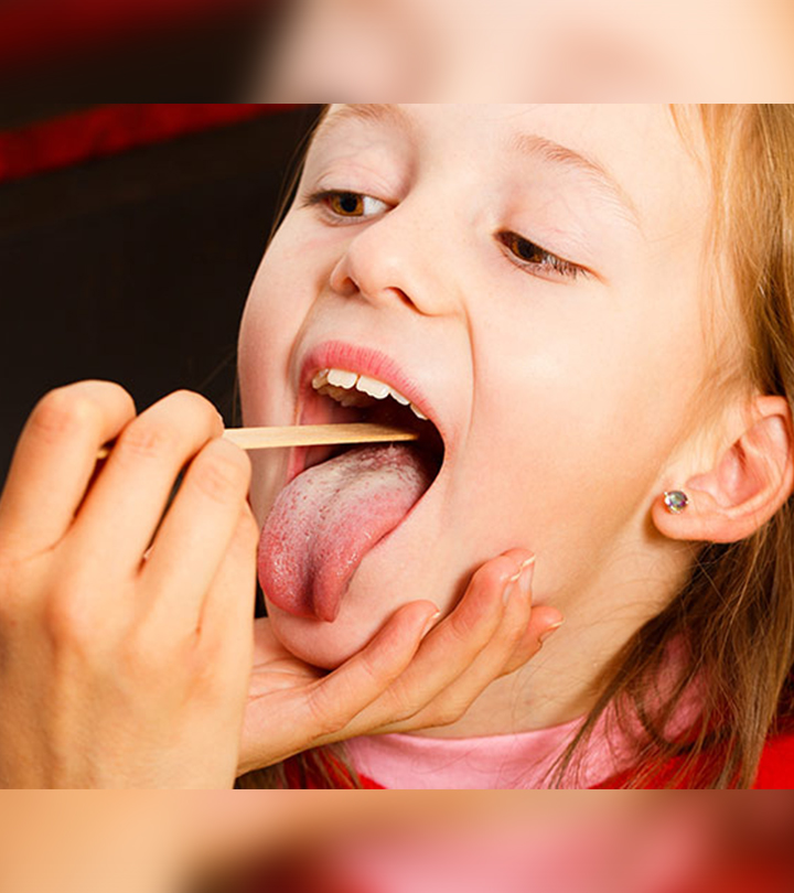 Gingivostomatitis In Children - Causes, Symptoms And Treatments