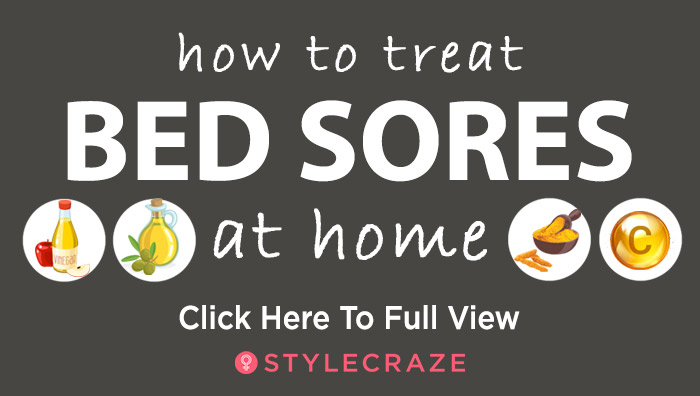 How-To-Get-Rid-Of-Bed-Sores---mini Treat Bed Sores - How-To-Get-Rid-Of-Bed-Sores---mini