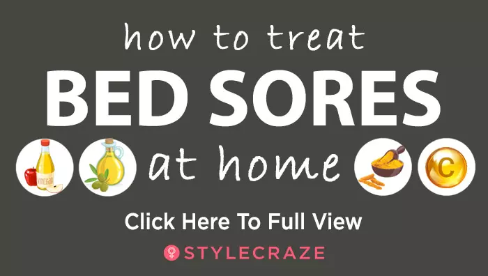 Treat Bed Sores - How-To-Get-Rid-Of-Bed-Sores---mini