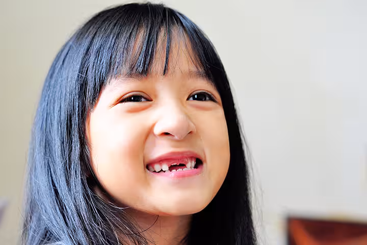 Chipped Tooth In Child Child's Chipped Tooth